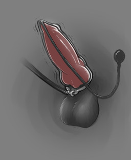 accessory animal_genitalia animal_penis canine_genitalia canine_penis catheter cock_ring foley_catheter genitals internal jewelry knot knotted_penis leash male medical_instrument parasite penetration penis penis_accessory penis_jewelry penis_only scientific_instrument sheath simple_background solo urethra urethral urethral_penetration loonertick mythology kiba_kurokage canid canine canis mammal mythological_canine mythological_creature werecanid werecanine werecreature werewolf wolf absurd_res hi_res
