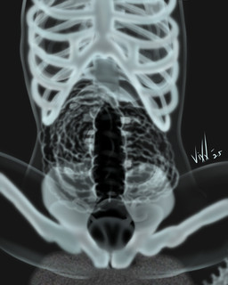 ambiguous_gender anal anal_knotting anal_penetration animal_genitalia animal_penis anthro black_cum black_penis bodily_fluids bone canine_genitalia canine_penis colored_cum cum cum_in_ass cum_in_intestines cum_inside duo female female_penetrated femur_(bone) genital_fluids genitals guts internal internal_anal internal_organs intestines knotting large_intestine organs pelvic_bone pelvis penetration penis rib_cage skeleton small_intestine unusual_bodily_fluids unusual_cum unusual_genital_fluids x-ray_view vixx vixx_(character) 4:5 digital_media_(artwork) digital_painting_(artwork) hi_res painting_(artwork) signature herm_(lore)