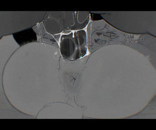 ahegao anthro anus balls black_balls black_body black_penis blush blush_lines bodily_fluids body_hair butt butt_focus butt_hair close-up clothed clothing cum cum_drip cum_in_vagina cum_inside cum_on_balls cum_on_penis cum_string dialogue dripping duo eyewear fangs female female_penetrated from_front_position genital_fluids genitals glasses hair hair_over_eye heart_symbol legwear looking_at_genitalia looking_at_penetration looking_at_penis looking_pleasured male male/female male_penetrating male_penetrating_female mating_press moan partially_clothed penetration penile penile_penetration penis penis_in_vagina profanity pussy_juice_bubble pussy_juice_on_balls sex stockings tail teeth tongue tongue_out vaginal vaginal_fluid_string vaginal_fluids vaginal_fluids_on_penis vaginal_penetration vulva wearing_glasses white_body goonie-san shizumoh andy_(shizumoh) goon_(goonie_san) arctic_fox canid canine canis domestic_dog fox mammal true_fox 2025 greyscale halftone monochrome trans_(lore) trans_man_(lore)