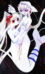 blood bodily_fluids breast_grab breasts conjoined featureless_breasts female female/female fin hair hand_on_breast split_form tail tail_fin white_body white_hair wounded yogurt200 humanoid marine merfolk hi_res