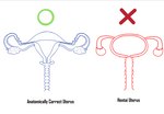 anatomically_correct anatomy cervix fallopian_tubes female genitals how-to not_furry organs ovaries pussy text the_more_you_know the_truth uterus zero_pictured crossman unknown_species biological_illustration english_text lol_comments technical_illustration