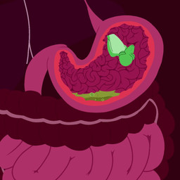 ambiguous_gender ambiguous_pred anthro bodily_fluids bone bottomwear bubble bubbling_acid burping clothing death digestion dissolved_clothing esophagus fatal_vore female guts intestines liver male nude organs overweight overweight_female pumping_intestines rapid_digestion rugae sizzling skeleton skirt solo sound_effects stomach stomach_acid swallowing topwear tube_top vore flightlesslizard sound_warning monitor_(flightlesslizard) gecko lizard mammal murid murine reptile rodent scalie 1:1 animated short_playtime sound video