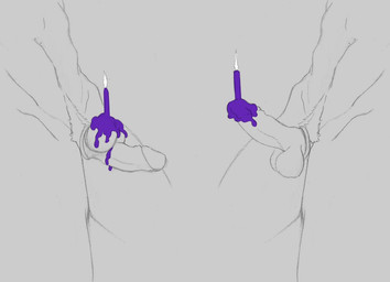 balls balls_above_penis candle cock_and_ball_torture comparison duo erection foreskin genital_torture genitals humanoid_genitalia humanoid_penis male penis retracted_foreskin simple_background wax_play 9x9 kangaroo macropod mammal marsupial traditional_media_(artwork)