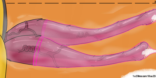 2_penises animal_genitalia animal_penis anthro big_penis bodily_fluids condom cum cum_inside egg egg_in_condom ejaculation erection excessive_cum excessive_genital_fluids filled_condom genital_fluids genitals gynomorph intersex measuring measuring_penis multi_genitalia multi_penis musk musky_penis nude oviposition penile_spines penis sexual_barrier_device simple_background slit_penis smelly_penis solo sweat tapering_penis unwashed vein veiny_penis wearing_condom yellow_body torielle69 katarina_flowerbloom arthropod bee hymenopteran insect absurd_res digital_media_(artwork) hi_res signature