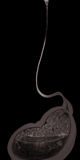 anthro bodily_fluids bone bones_in_stomach da digested digestion digestion_implied digestive_fluids female genitals internal oral_vore reverse_mouth_shot saliva simple_background size_difference soft_vore solo swallowing text uvula vore vulva dangerouslygooey gooey_(dangerouslygooey) lagomorph mammal absurd_res digital_drawing_(artwork) digital_media_(artwork) english_text hi_res long_image tall_image