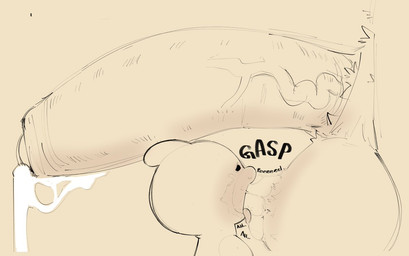 ambiguous_gender antennae_(anatomy) anthro ball_worship balls big_balls big_penis bodily_fluids body_worship duo fur genital_fluids genital_worship genitals huge_balls huge_penis hyper looking_pleasured male penis precum pubes saliva saliva_on_balls saliva_string side_view size_difference tongue tongue_out vein veiny_penis sushiamazing bits_and_bops sushi_(sushiamazing) arthropod caterpillar domestic_cat felid feline felis insect larva mammal 2025 digital_media_(artwork) monochrome sketch