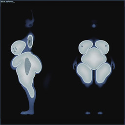 anthro belly belly_overhang big_belly big_breasts big_butt big_nipples bone brain breasts butt cross_section erect_nipples female front_view huge_breasts huge_butt nipples nude nude_anthro nude_female organs overweight overweight_female sagging_breasts side_view skeleton solo thick_thighs wide_hips x-ray_view orilas hilwu canid canine fox mammal 1:1 2026 3d_(artwork) animated blender_(artwork) digital_media_(artwork) no_sound short_playtime webm