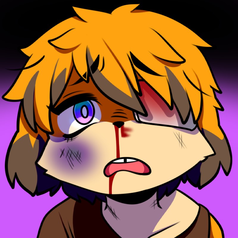 ambiguous_gender anthro blood blue_eyes bodily_fluids brown_hair bruised eye_patch eyewear frown fur gradient_background hair multicolored_hair nosebleed open_mouth orange_body orange_fur orange_hair pupils simple_background solo two_tone_hair white_pupils wounded berseepon09 dog_girl_(berseepon09) canid canine canis domestic_dog mammal 1:1 2017 digital_media_(artwork) female_(lore)